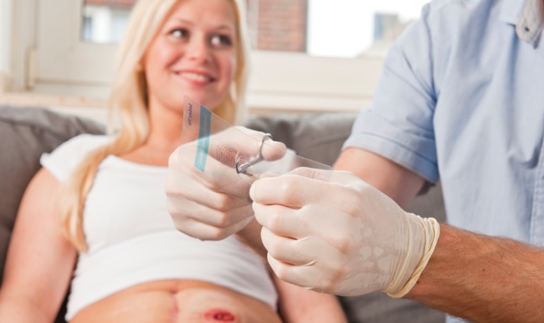 Stomaplatte löst sich ständig? Maßgefertigte Stomaplatten von Coloplast Homecare können helfen!